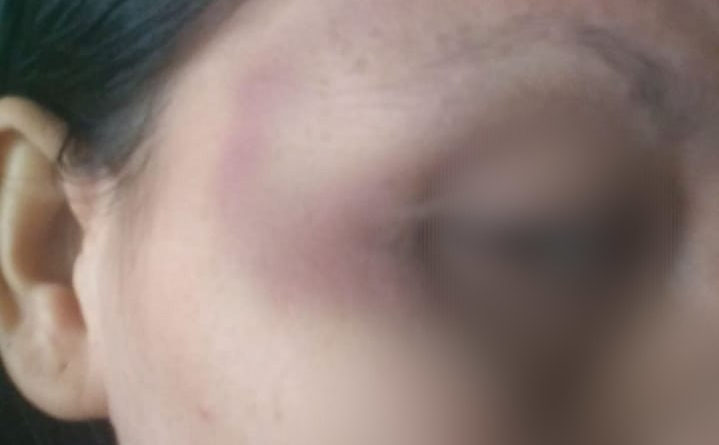 Medanoke.com-korban kekerasan wanita